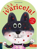 1, 2, 3... ¡VARICELA!